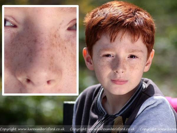 Young boy with ginger hair and freckles